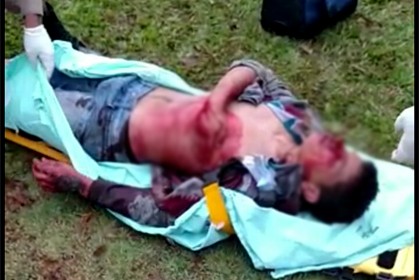 capa-jovem-sofre-tentativa-de-homicidio-capa_vilhena_noticias_22-01-2017-27