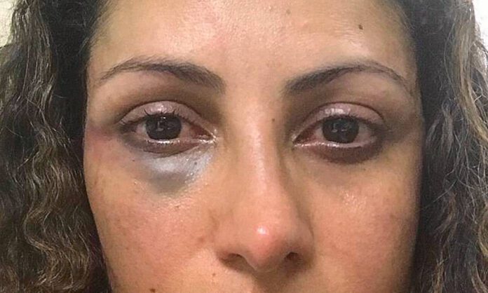 violencia-contra-a-mulher