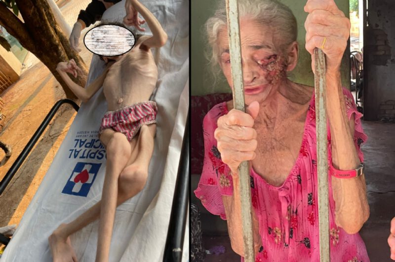 Em cidade do MT, menor de 17 anos com microcefalia e idosa de 76 com ferida por câncer são resgatadas thumbnail