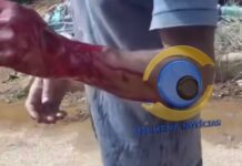 Homem ferido com suspeita de facada recusa atendimento e deixa moradores apreensivos em Vilhena