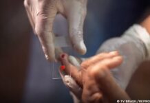 SUS começa a usar novo tratamento contra a malária em crianças