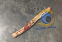 Discussão durante bebedeira termina em agressões com pedaço de madeira e caso vai parar na UNISP em Vilhena