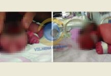 Bebê com condição congênita grave morre dois dias após o nascimento em Vilhena