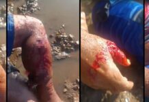 Assista: pescador fica gravemente ferido após ser atacado por jacaré no Rio Araguaia